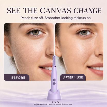RYVO™ Sonic Dermaplaning Tool