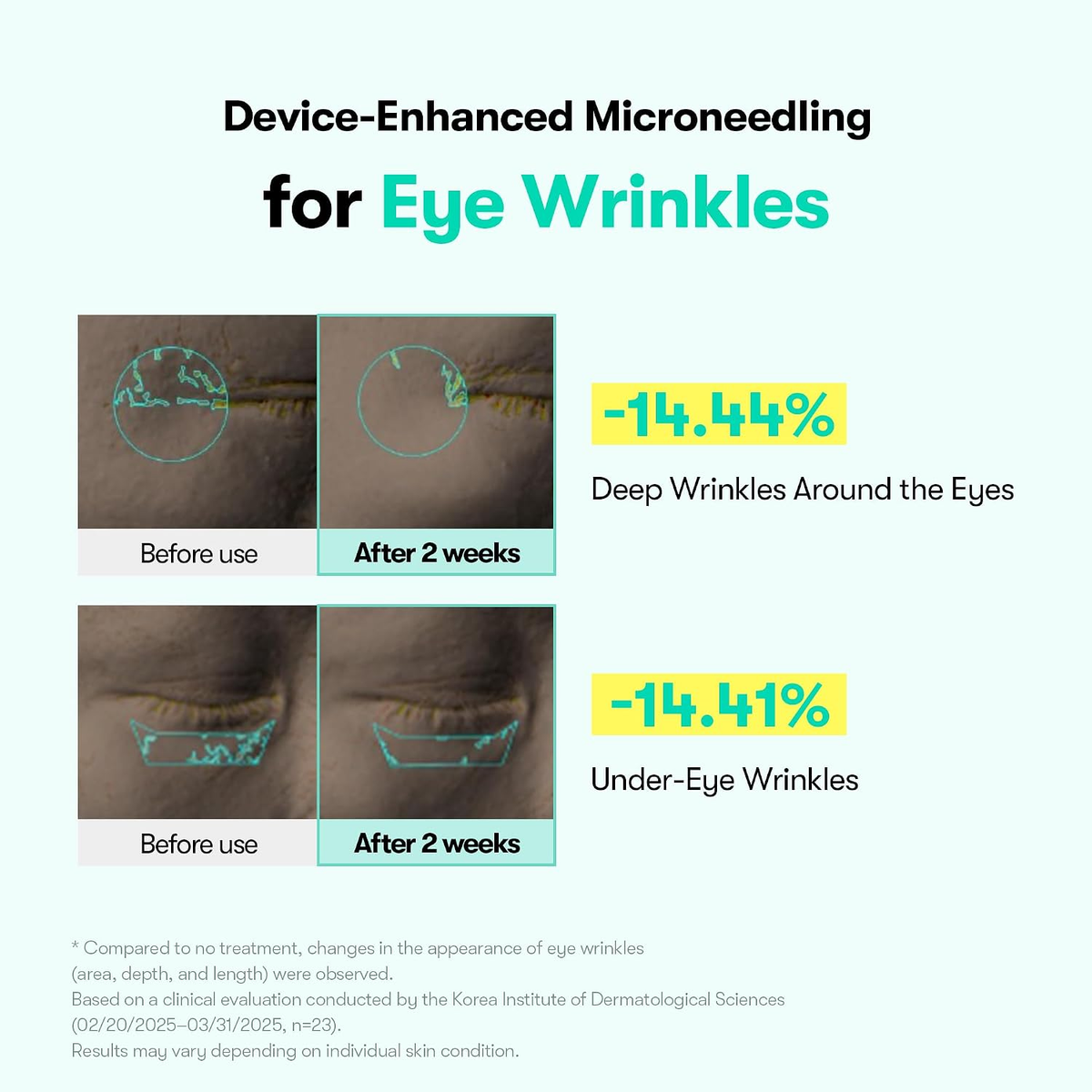 PDRN Micro-Vibration Eye Cream